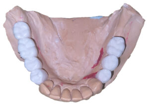 Encerado dental diagnóstico
