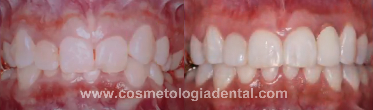 Ortodoncia, Implantes dentales, Blanqueamiento dental, Resinas dentales